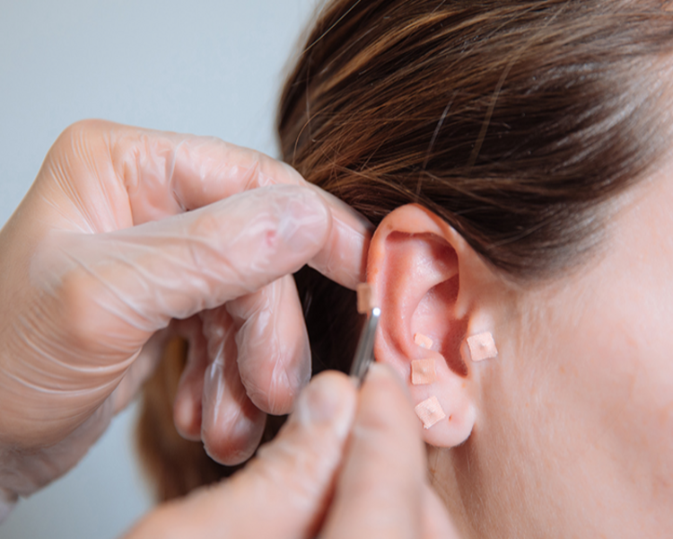 Promoción Sesion Ventosa + Auriculoterapia 