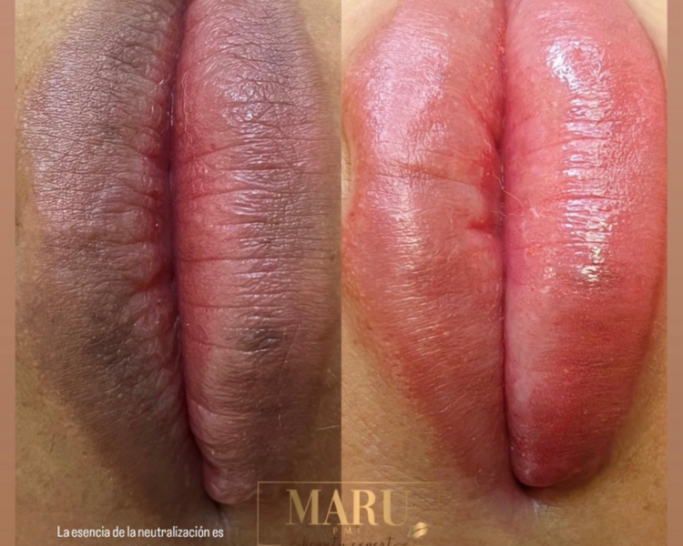 Neutralización labial