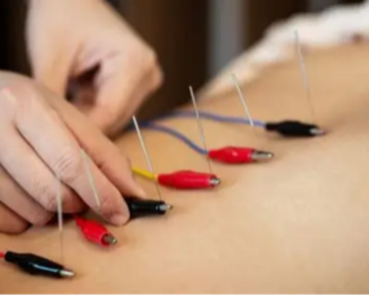 Masaje descontracturante con ventosas y electro-acupuntura