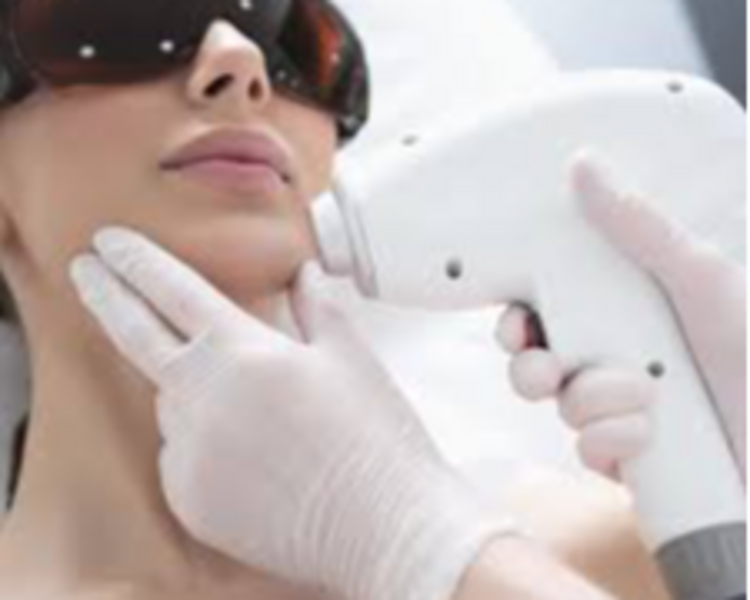 Depilación Láser Zona A (Bigote, Entrecejo, Frente, Manos, Menton, Ombligo, Orejas, Pezon, Pies, 1/2 linea abdomen)