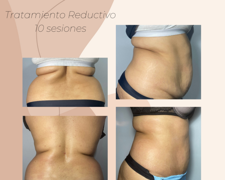 Reductivo & Reafirmante 