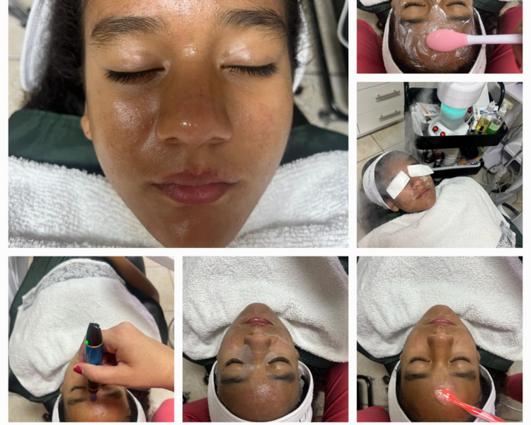 Limpieza Facial