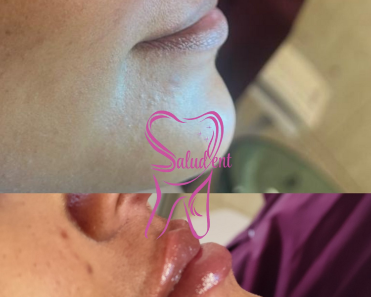 Armoinizacion Facial