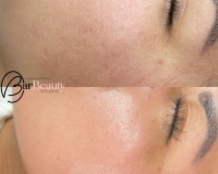 Peeling Orgánico Barbeauty (Rostro)