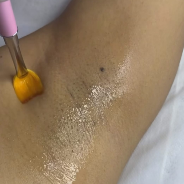 Tratamiento para el Aclarado de zonas oscuras