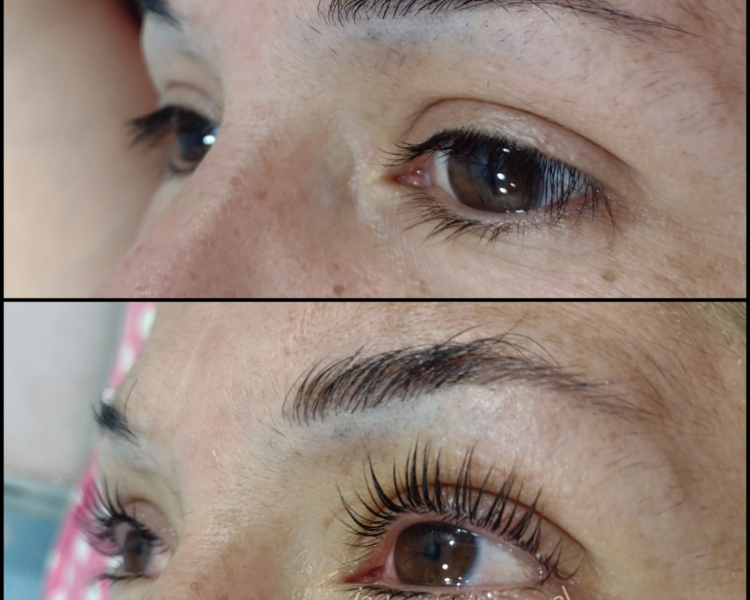 Lifting de pestañas + botox