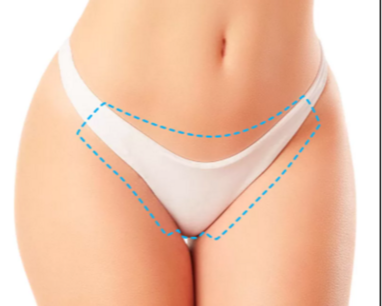 Depilación rebaje largo 