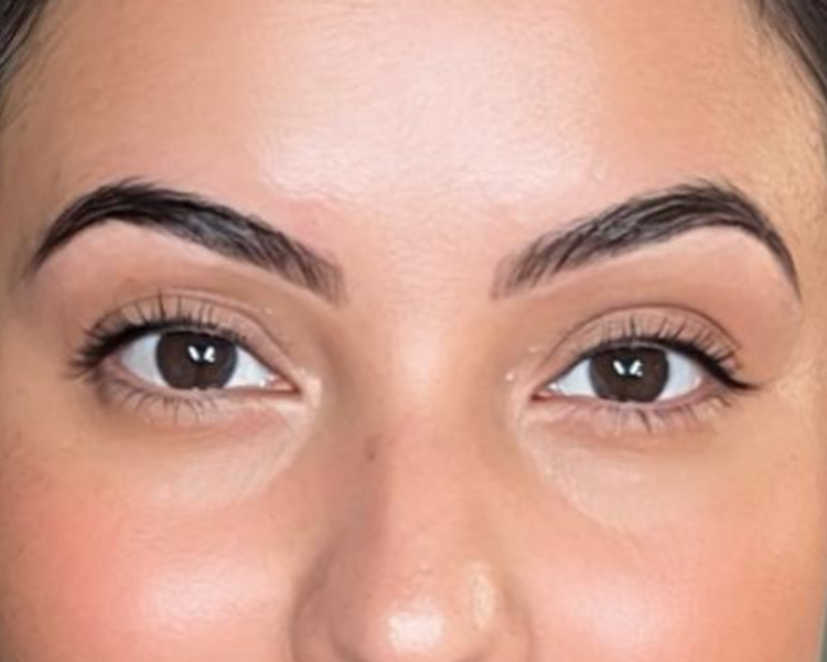 Mirada Navideña: Spa de Cejas + Botox. 