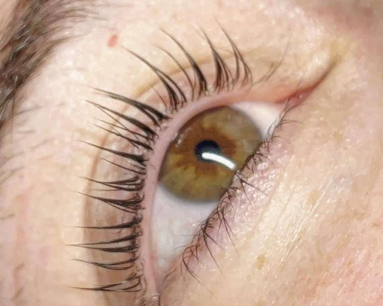 Lifting Sunshine con tinte y tratamiento botox. 