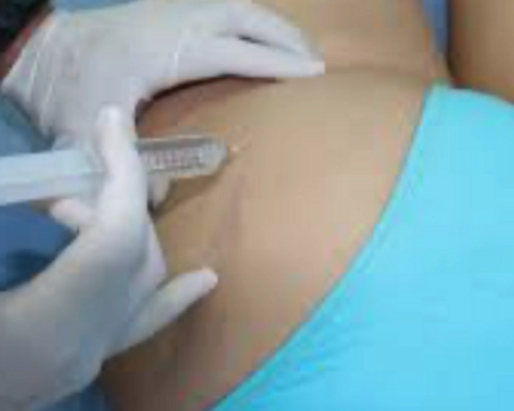 Celulitis Tratamiento de Ozono/ Cellulitis Ozone Treatment ( 6 sesiones)