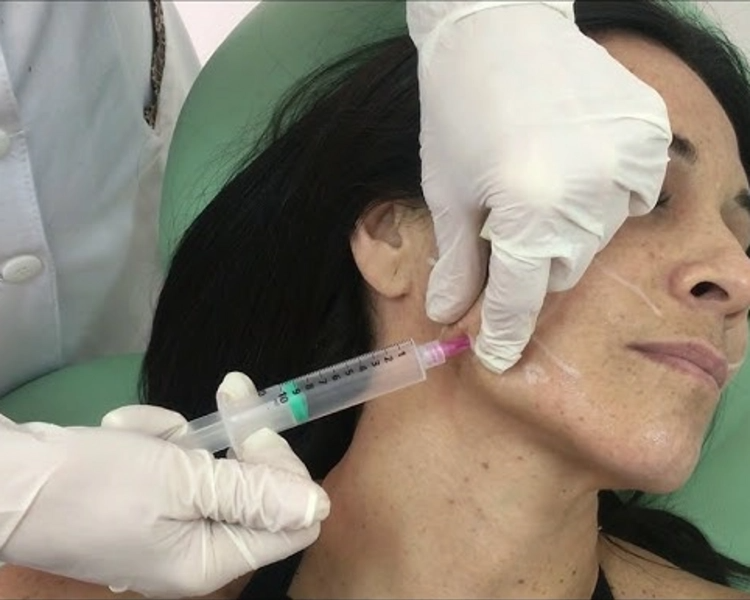 Inyecciones Intradermicas de Ozono ( 3 sesiones)