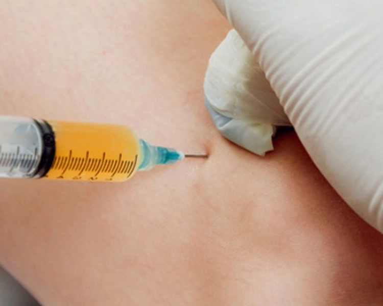 Infiltración c Acido Hialuronico una articulación