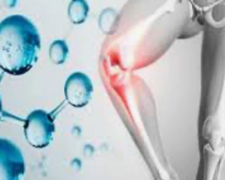 Infiltaciones / Infiltrations ( Individual de Ozono General )