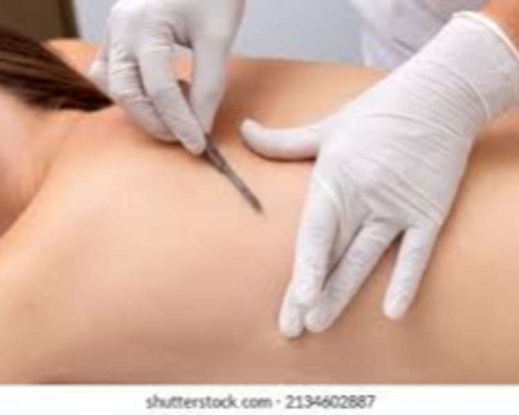 DERMAPLANING CORPORAL x 1 zona