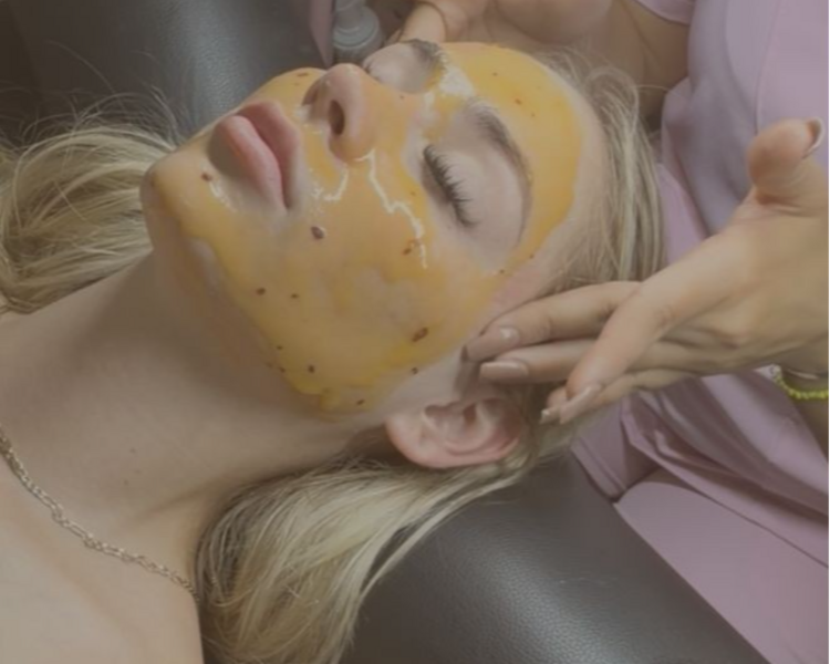 Facial Antiacne con dermabrasión