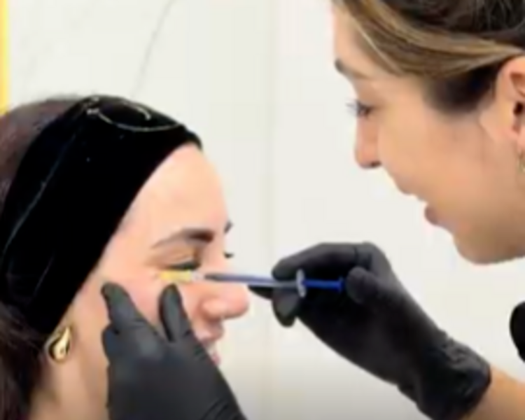 Botox (3 zonas + retoque)