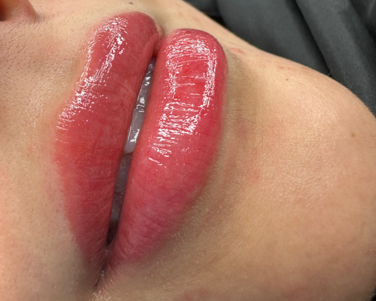 MICROPIGNENTACION DE LABIOS