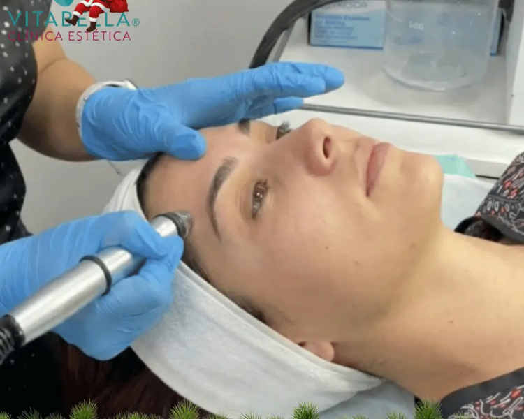 Limpieza Facial Profunda con Hydrapeeling Aquabella