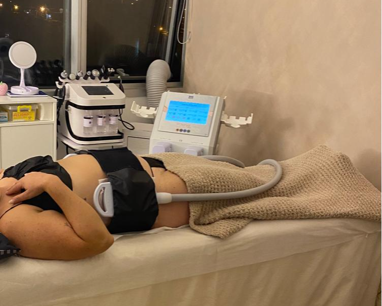 Criolipólisis abdomen completo