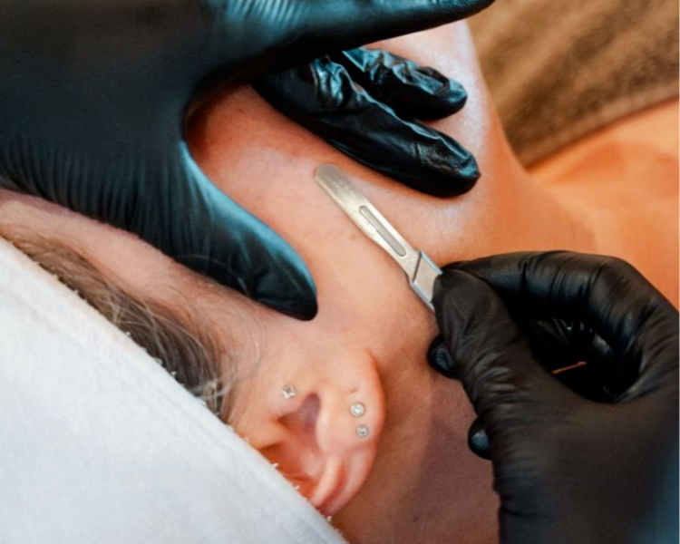 Oxigenación facial completa con dermaplaning