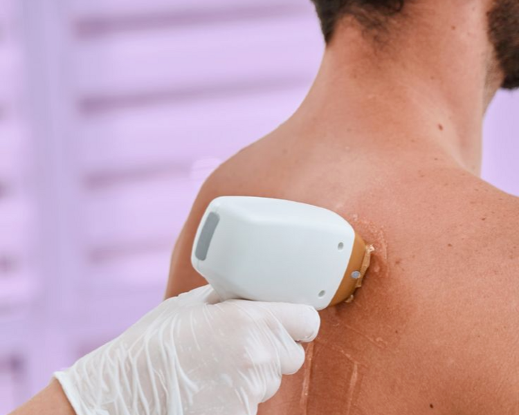 Pack Full VeranoMen Axilas + Brazos + Piernas + Espalda + Abdomen + Zona íntima Full