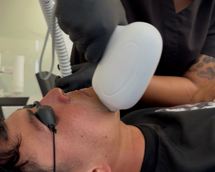 Pack FreshMen Barba + Axilas + Línea Alba