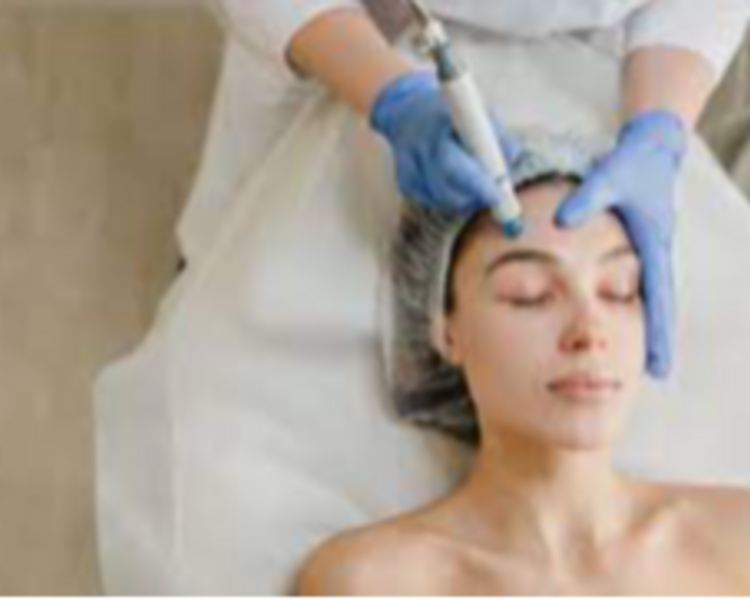Limpieza Facial con Dermapen (Microneendling superficial)
