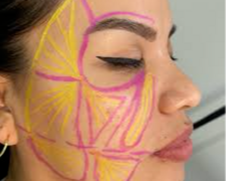 Adipoestructuración Facial + Papada