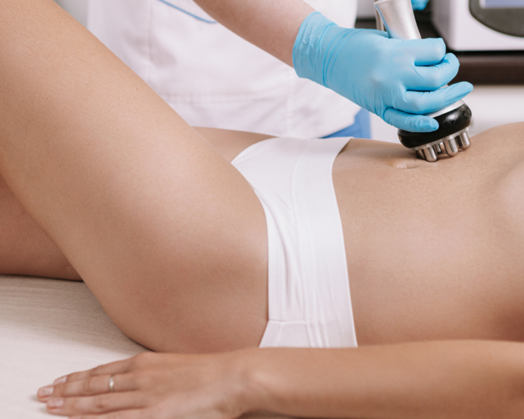 Radiofrecuencia facial y corporal