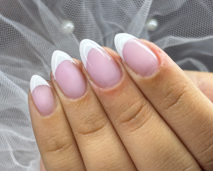 Kapping en gel DESDE