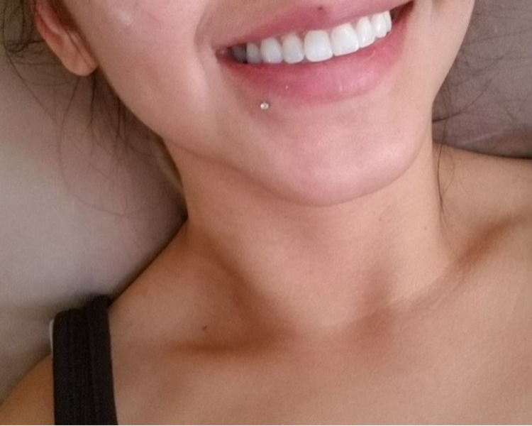 Labret