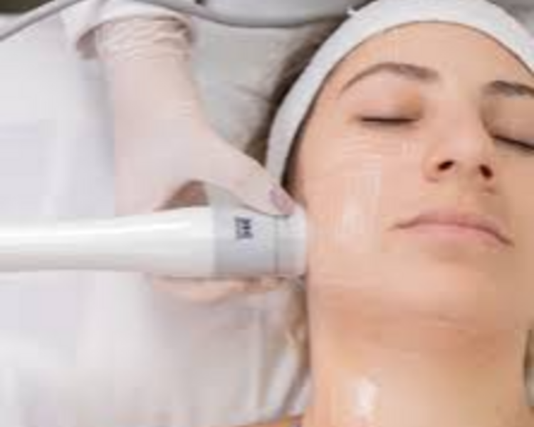 Hifu Sonofocus Rostro (1 sesión)