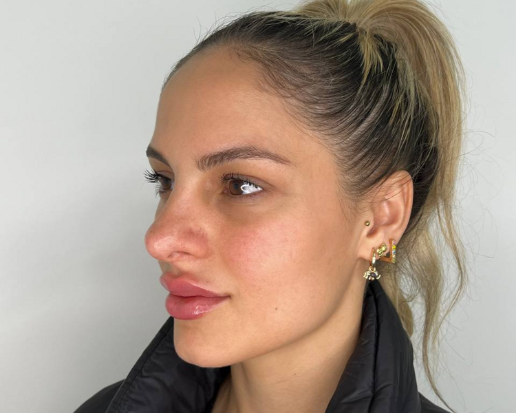 *Consulta* Tto. de *Plasma*