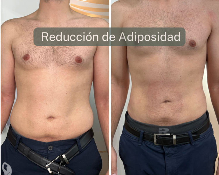 *Consulta Gratis* Tto. de *Mela*