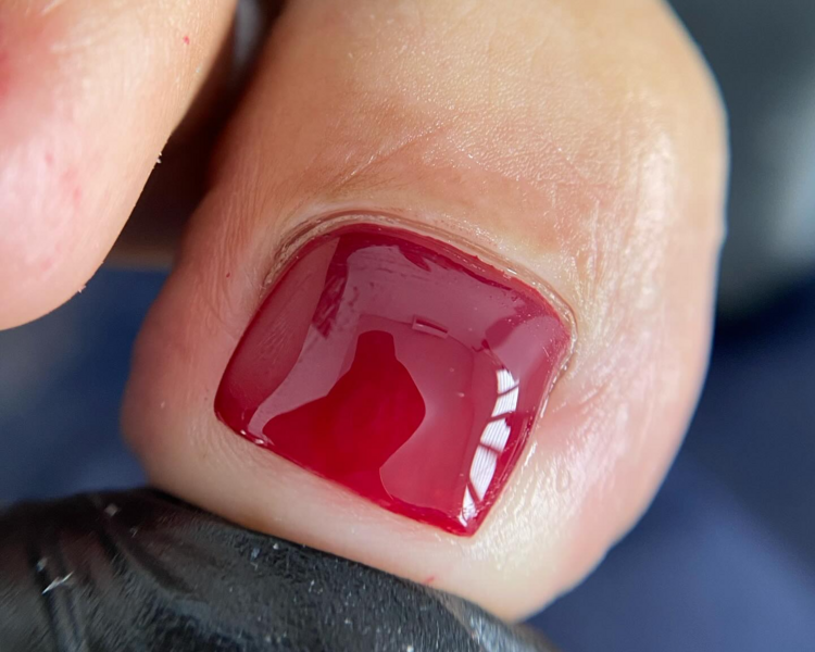 Gel + servicio preventivo