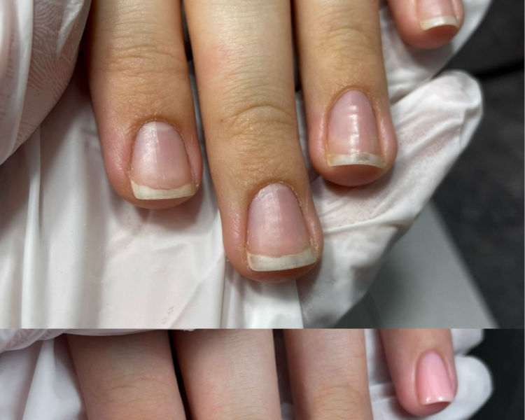 Retiro de Esmalte Permanente