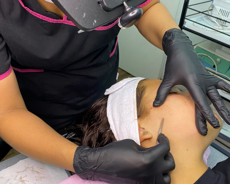 Limpieza Profunda + DERMAPLANING