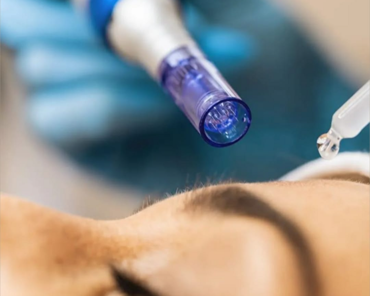 TRATAMIENTO PARA LINEAS DE EXPRESION 