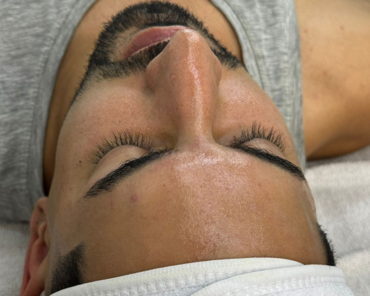 Limpieza Facial Profunda