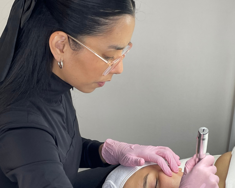 ✨ Peeling Antioxidante & Revitalizante con Dermapen ✨