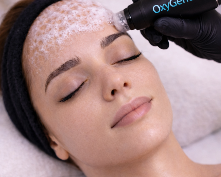 Carboxiterapia Topica