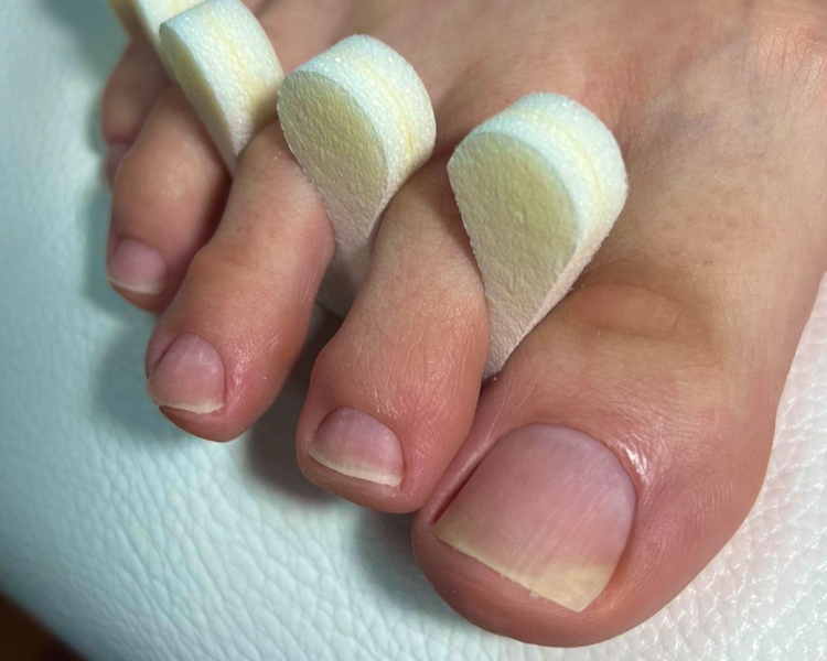 CORTE Y EMPAREJAMIENTO DE UÑAS