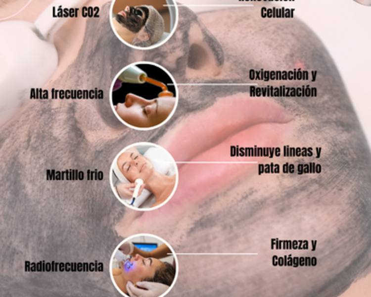 Lifting Complexe Glow