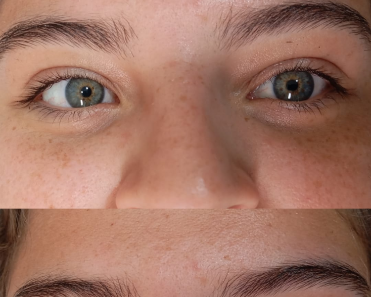 ONDULACION DE PESTAÑAS