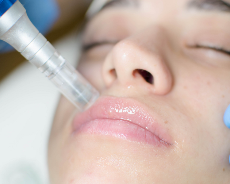 ** Glow perfect party** : pieles +40 - PROMO EFT 30% OFF