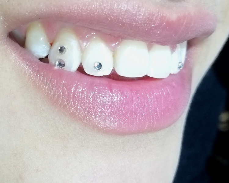 Gema CIRCULAR U OVALADA