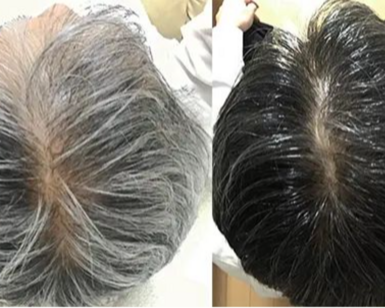 Cubrimiento De Canas 