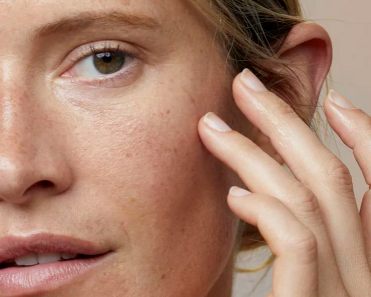 ✨Tratamiento despigmentante en ojeras✨