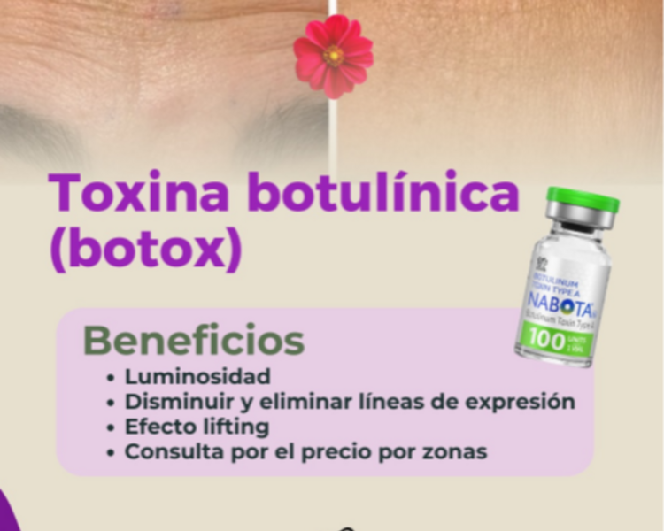 Toxina botulínica: 1 zona