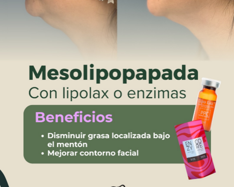 mesolipopapada con Lipolax (3 sesiones)